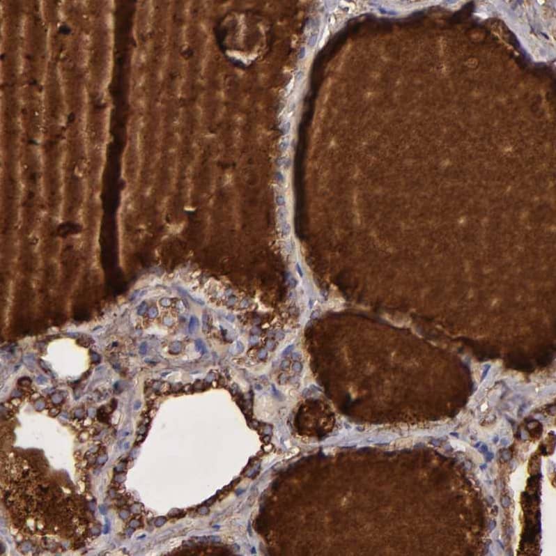 Thyroglobulin Antibody - BSA Free Immunohistochemistry: Thyroglobulin Antibody - BSA Free [NBP1-90200]
