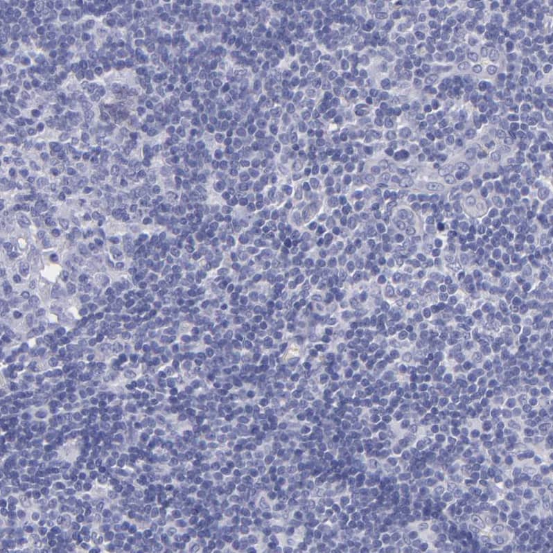 Thyroglobulin Antibody - BSA Free Immunohistochemistry: Thyroglobulin Antibody - BSA Free [NBP1-90200]