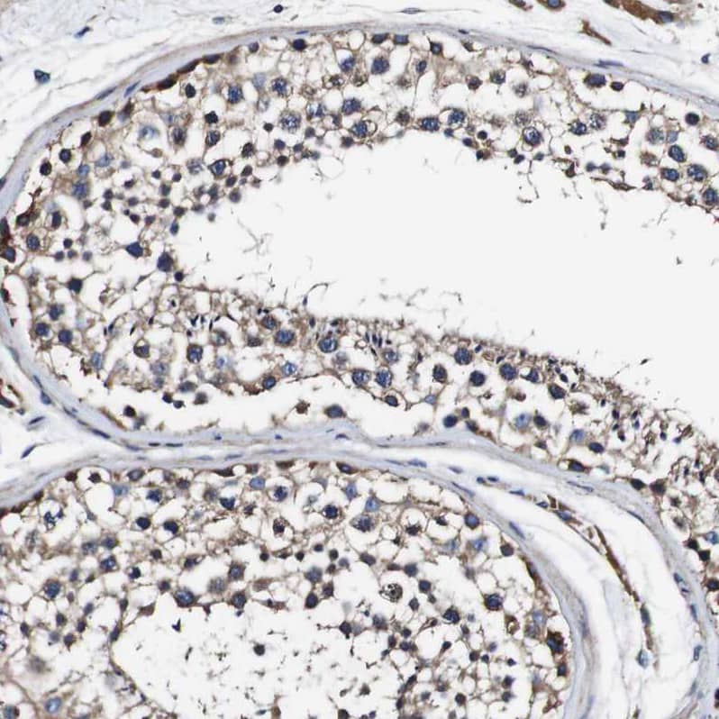 Alix Antibody - BSA Free Immunohistochemistry: Alix Antibody - BSA Free [NBP1-90201]