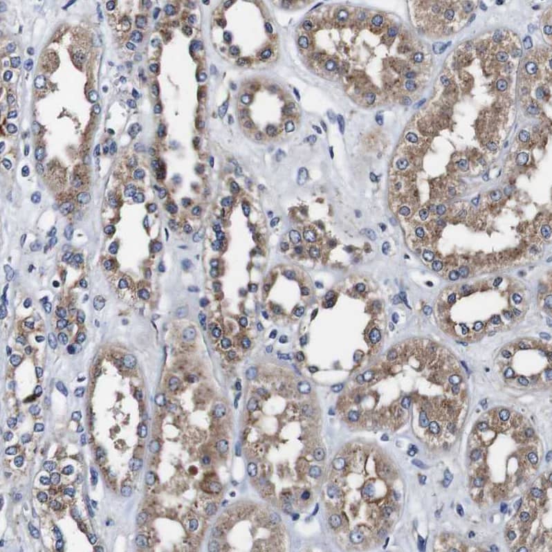 Alix Antibody - BSA Free Immunohistochemistry: Alix Antibody - BSA Free [NBP1-90201]