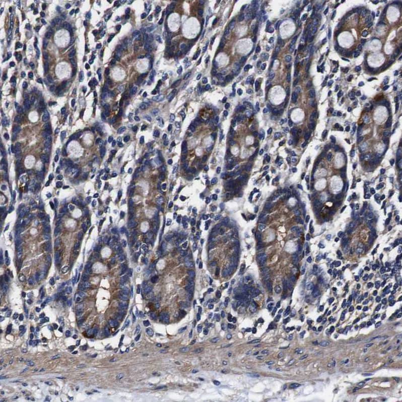 Alix Antibody - BSA Free Immunohistochemistry: Alix Antibody - BSA Free [NBP1-90201]
