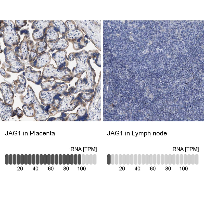 Jagged 1 Antibody - BSA Free Immunohistochemistry: Jagged 1 Antibody - BSA Free [NBP1-90208]