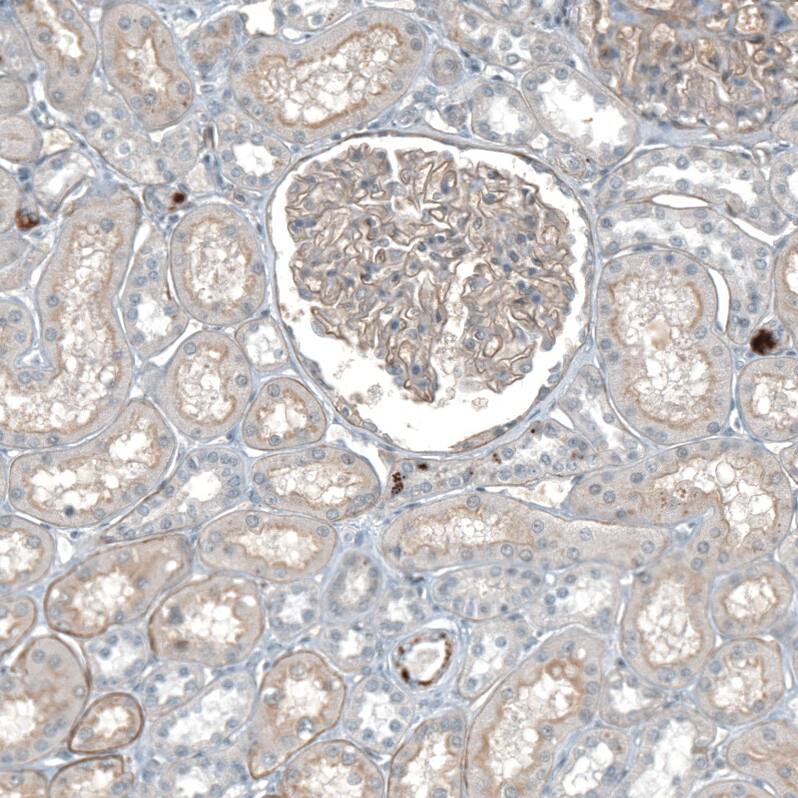 Agrin Antibody - BSA Free Immunohistochemistry-Paraffin: Agrin Antibody [NBP1-90209]