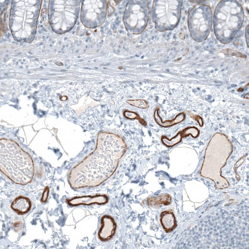 Agrin Antibody - BSA Free Immunohistochemistry-Paraffin: Agrin Antibody [NBP1-90209]