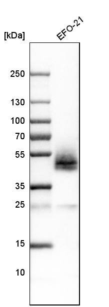 Podoplanin Antibody - BSA Free Western Blot: Podoplanin Antibody - BSA Free [NBP1-90211]