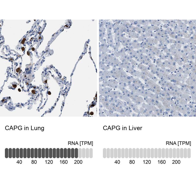 CapG Antibody - BSA Free Immunohistochemistry: CapG Antibody - BSA Free [NBP1-90214]