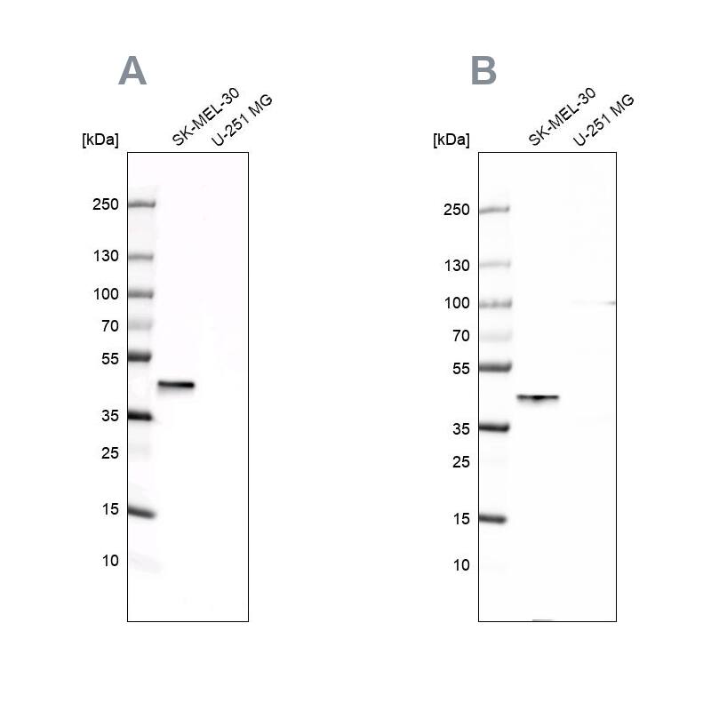 CapG Antibody - BSA Free Western Blot: CapG Antibody - BSA Free [NBP1-90214]