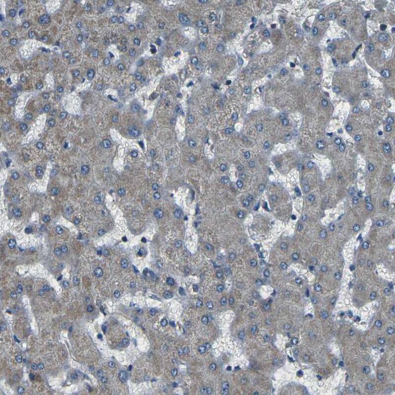 AFAP Antibody - BSA Free Immunohistochemistry: AFAP Antibody - BSA Free [NBP1-90216]