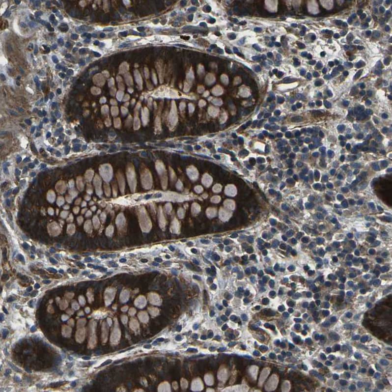 AFAP Antibody - BSA Free Immunohistochemistry: AFAP Antibody - BSA Free [NBP1-90216]