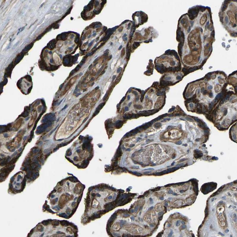 AFAP Antibody - BSA Free Immunohistochemistry: AFAP Antibody - BSA Free [NBP1-90216]