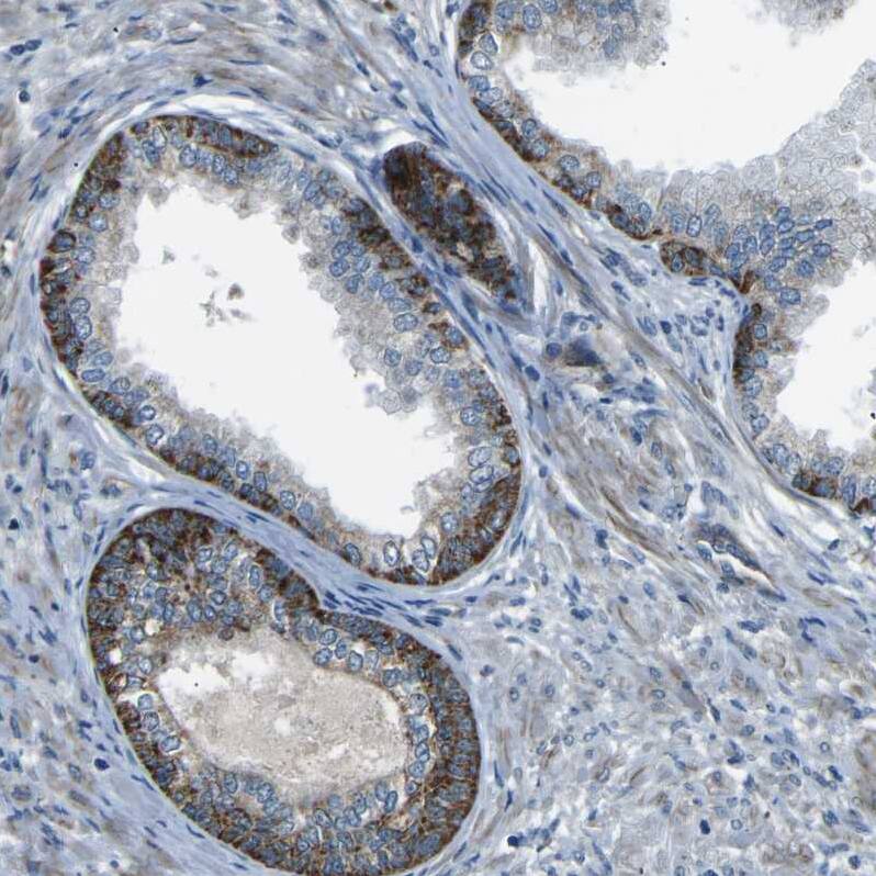 AFAP Antibody - BSA Free Immunohistochemistry: AFAP Antibody - BSA Free [NBP1-90216]