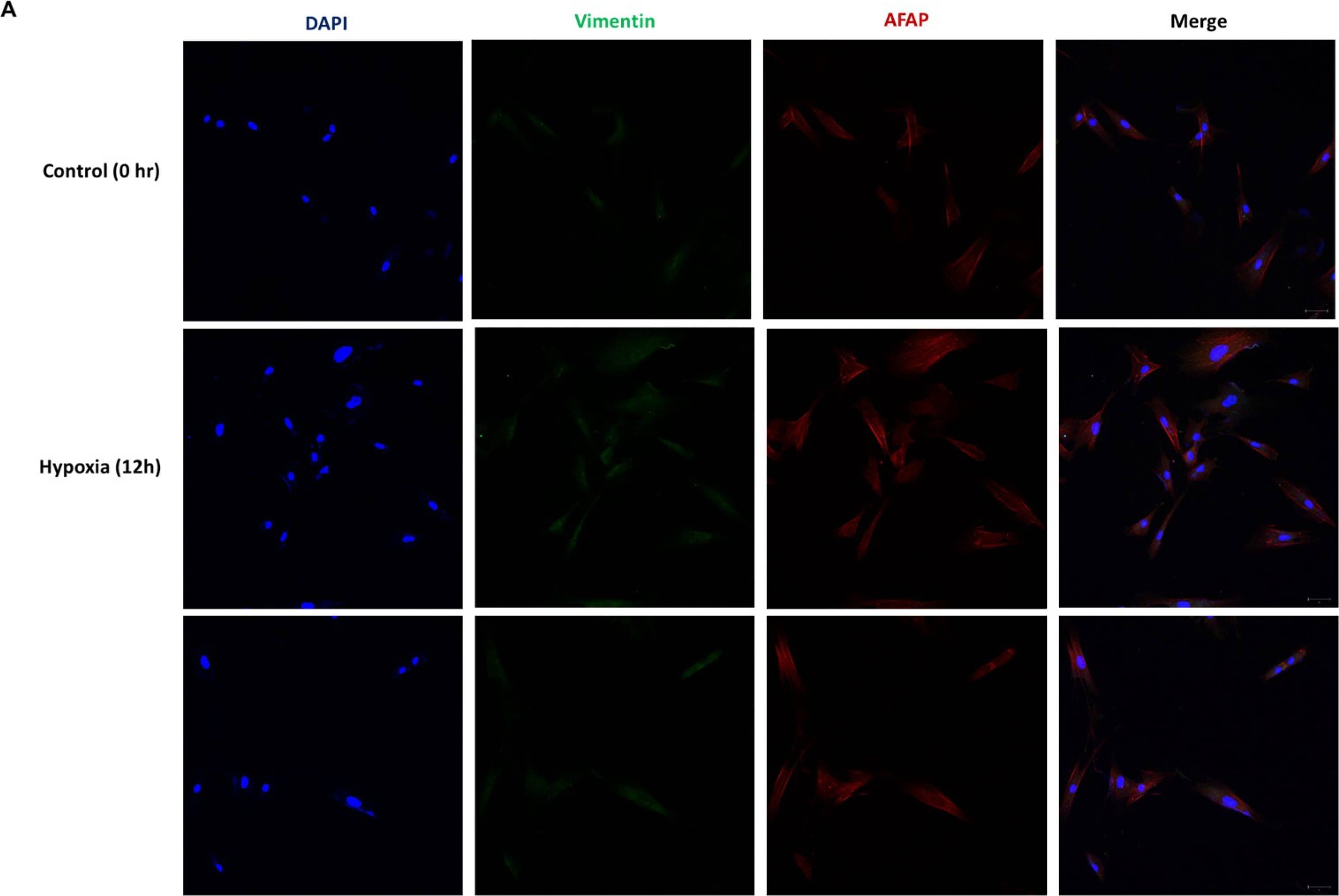 AFAP Antibody