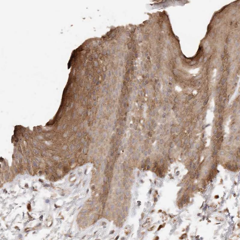 Afadin/AF-6 Antibody - BSA Free Immunohistochemistry-Paraffin: Afadin/AF-6 Antibody [NBP1-90218]