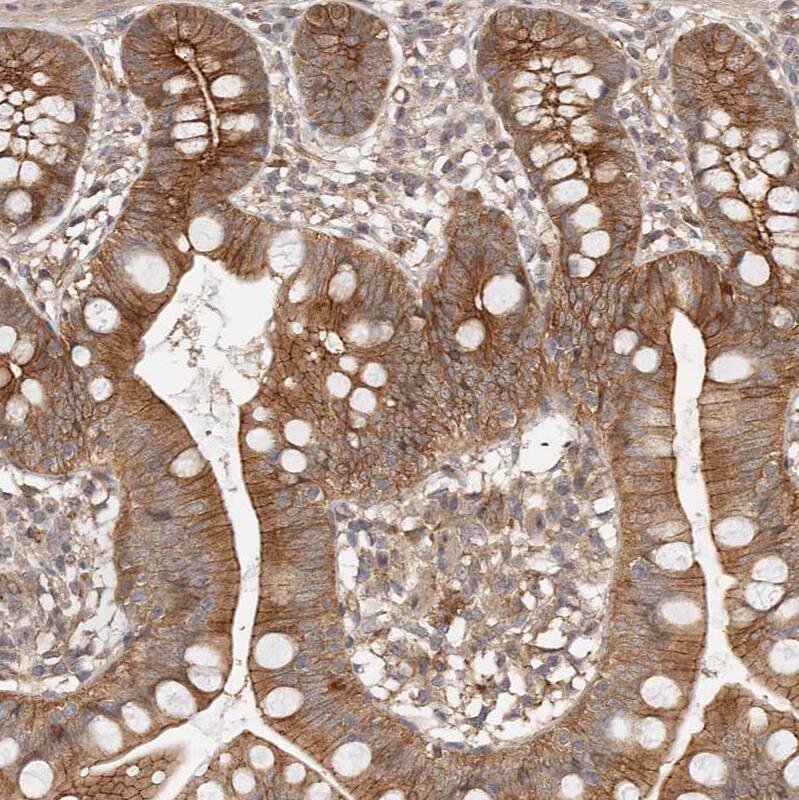 Afadin/AF-6 Antibody - BSA Free Immunohistochemistry-Paraffin: Afadin/AF-6 Antibody [NBP1-90218]