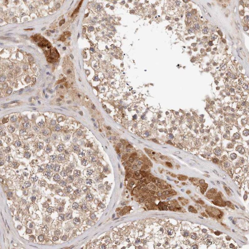 Afadin/AF-6 Antibody - BSA Free Immunohistochemistry-Paraffin: Afadin/AF-6 Antibody [NBP1-90218]