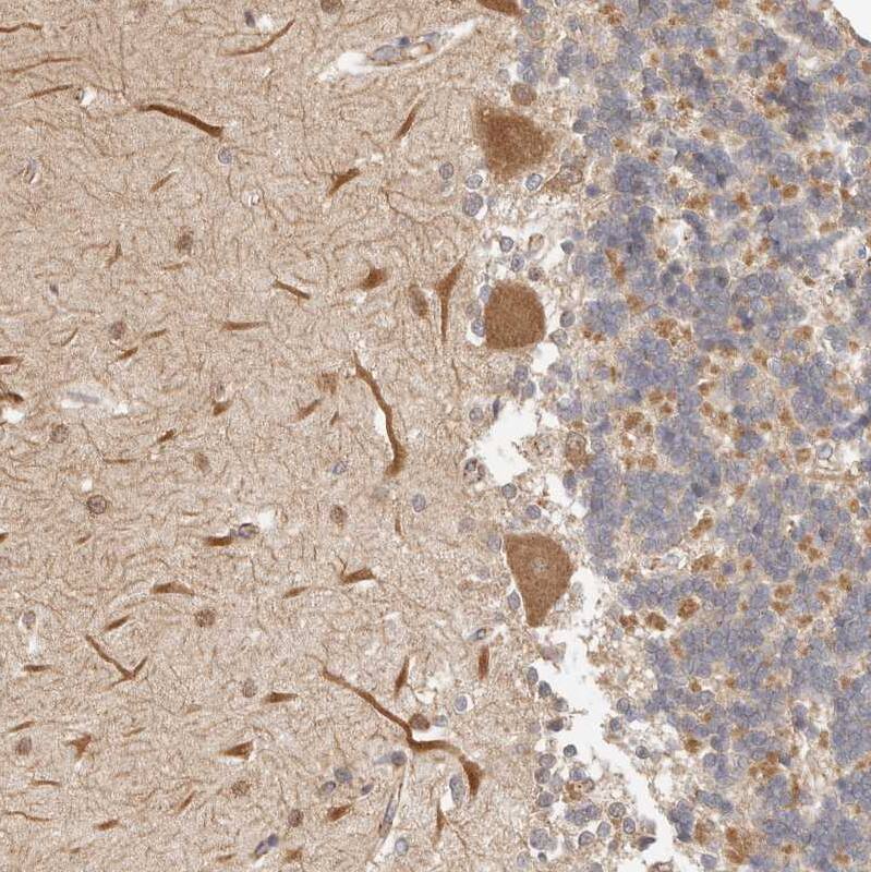 Afadin/AF-6 Antibody - BSA Free Immunohistochemistry-Paraffin: Afadin/AF-6 Antibody [NBP1-90218]