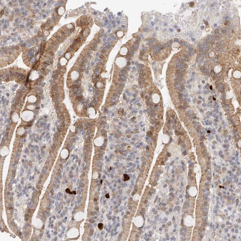 Afadin/AF-6 Antibody - BSA Free Immunohistochemistry: Afadin/AF-6 Antibody - BSA Free [NBP1-90219]
