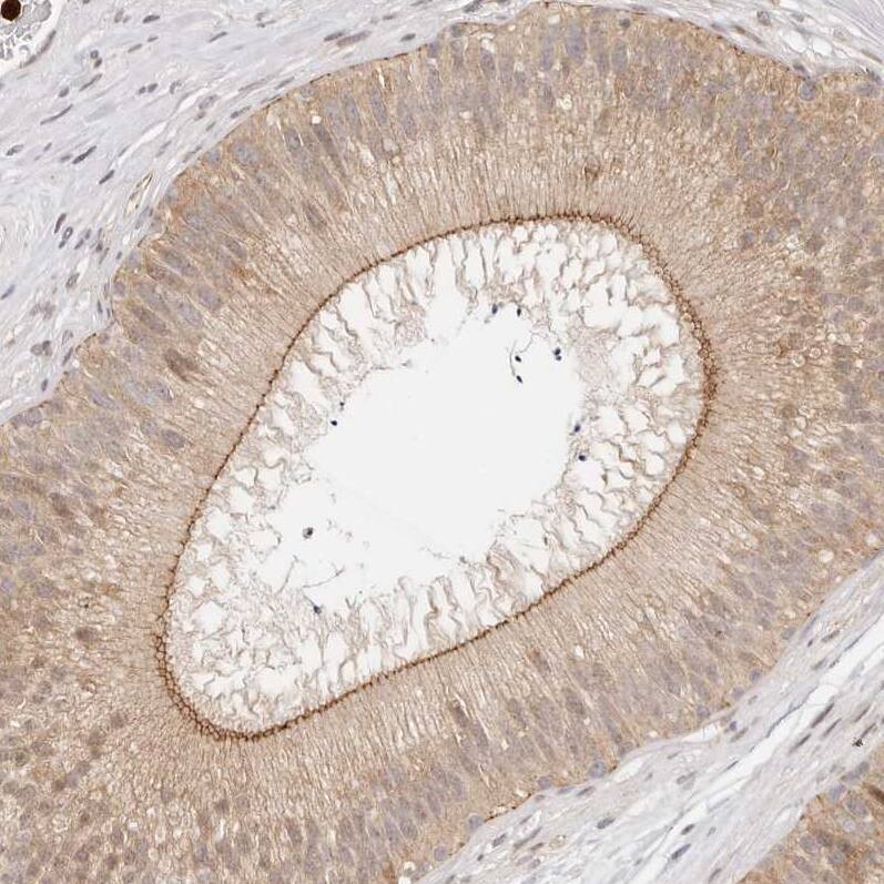 Afadin/AF-6 Antibody - BSA Free Immunohistochemistry: Afadin/AF-6 Antibody - BSA Free [NBP1-90219]