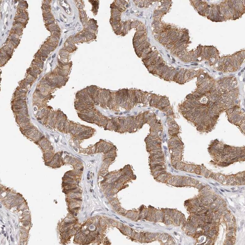 Afadin/AF-6 Antibody - BSA Free Immunohistochemistry: Afadin/AF-6 Antibody - BSA Free [NBP1-90219]
