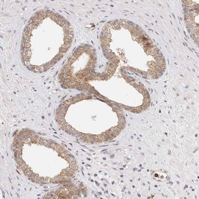 Afadin/AF-6 Antibody - BSA Free Immunohistochemistry: Afadin/AF-6 Antibody - BSA Free [NBP1-90219]