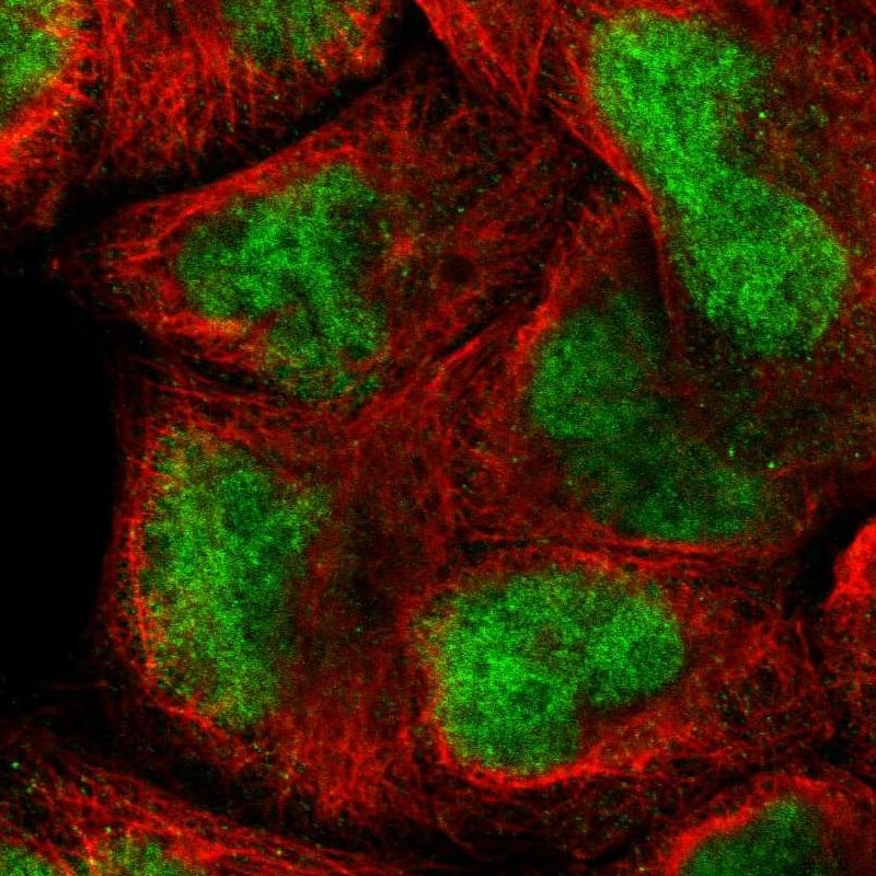 AF10 Antibody - BSA Free Immunocytochemistry/ Immunofluorescence: AF10 Antibody [NBP1-90222]