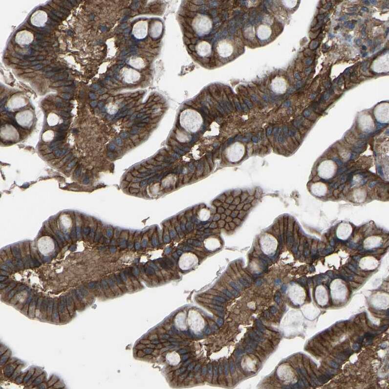 AE2 Antibody - BSA Free Immunohistochemistry: AE2 Antibody - BSA Free [NBP1-90225]