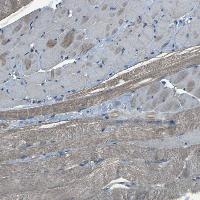 AE2 Antibody - BSA Free Immunohistochemistry: AE2 Antibody - BSA Free [NBP1-90225]
