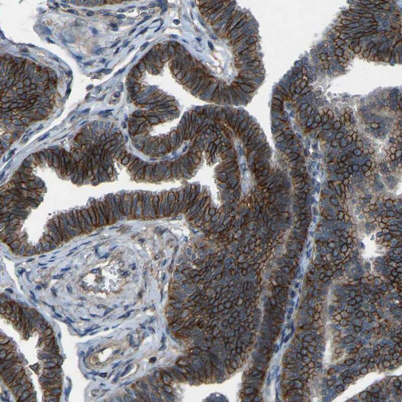 AE2 Antibody - BSA Free Immunohistochemistry: AE2 Antibody - BSA Free [NBP1-90225]