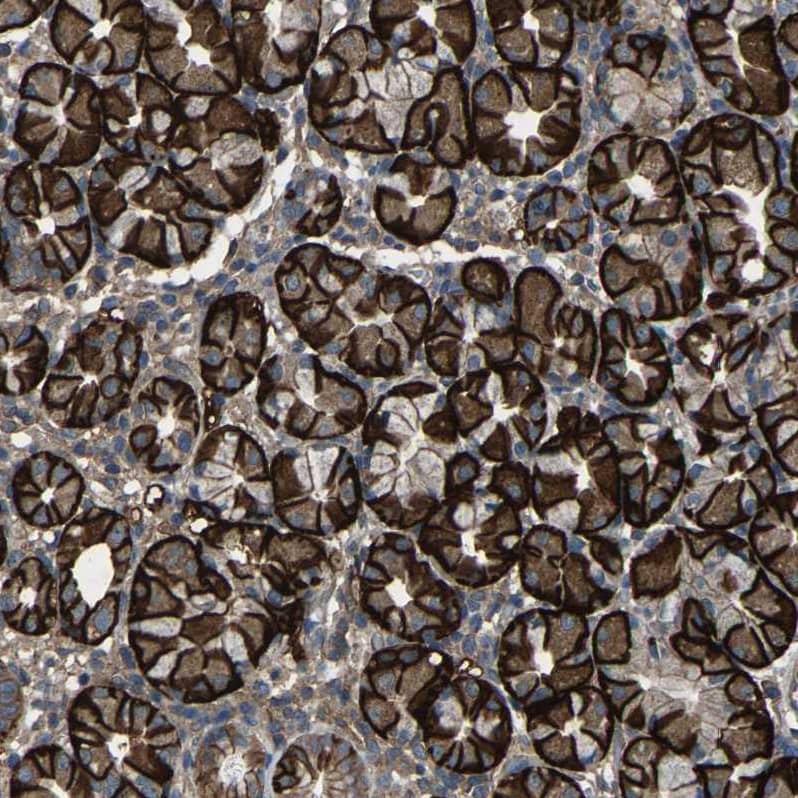AE2 Antibody - BSA Free Immunohistochemistry: AE2 Antibody - BSA Free [NBP1-90225]