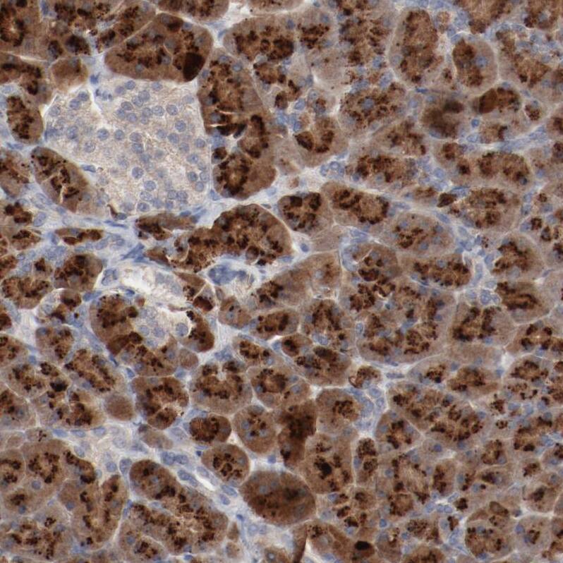 beta-2 Adrenergic R/ADRB2 Antibody - BSA Free Immunohistochemistry: beta-2 Adrenergic R/ADRB2 Antibody - BSA Free [NBP1-90227]