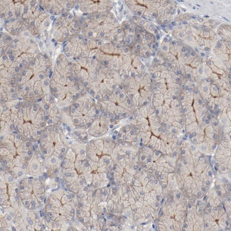 beta-2 Adrenergic R/ADRB2 Antibody - BSA Free Immunohistochemistry: beta-2 Adrenergic R/ADRB2 Antibody - BSA Free [NBP1-90227]