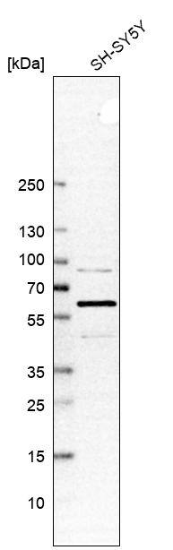 Spastin Antibody - BSA Free Western Blot: Spastin Antibody - BSA Free [NBP1-90230]