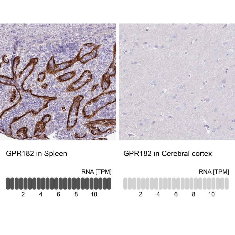 Adrenomedullin R/ADMR/GPR182 Antibody - BSA Free Immunohistochemistry: Adrenomedullin R/ADMR/GPR182 Antibody - BSA Free [NBP1-90231]