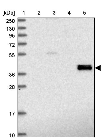 alcohol dehydrogenase 7 Antibody - BSA Free Western Blot: alcohol dehydrogenase 7 Antibody - BSA Free [NBP1-90232]