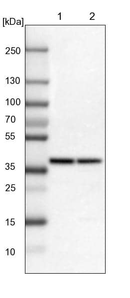 alcohol dehydrogenase 7 Antibody - BSA Free Western Blot: alcohol dehydrogenase 7 Antibody - BSA Free [NBP1-90232]
