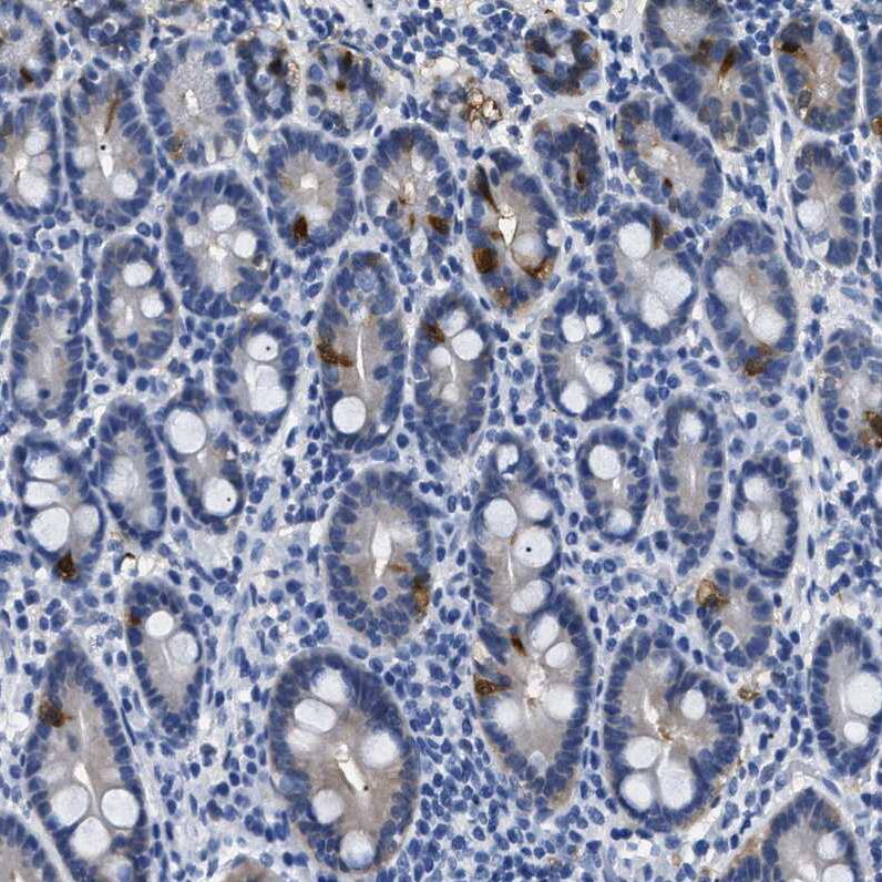 alcohol dehydrogenase 4 Antibody - BSA Free Immunohistochemistry: alcohol dehydrogenase 4 Antibody - BSA Free [NBP1-90233]