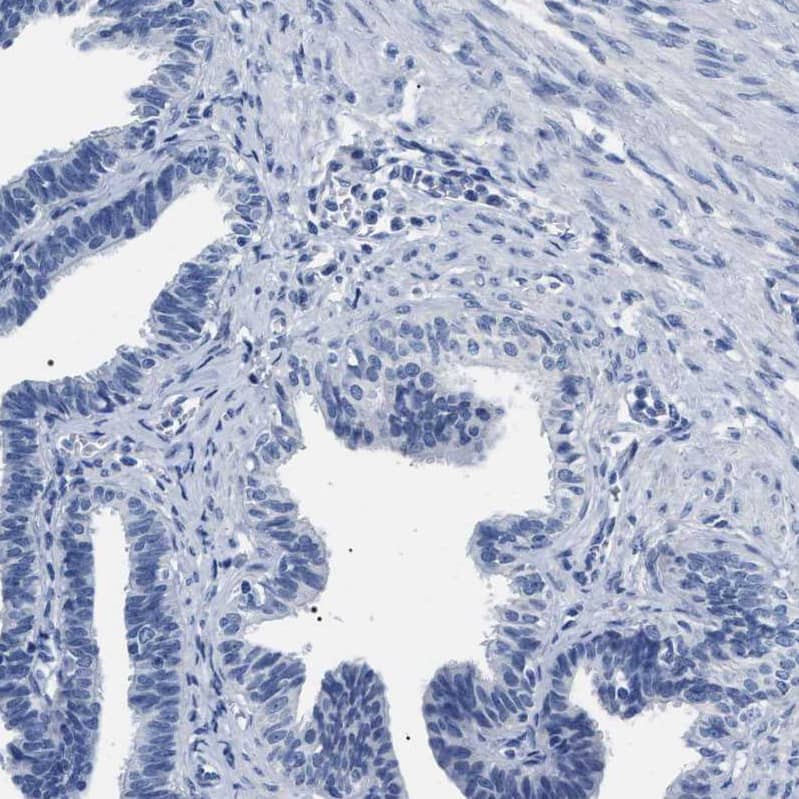 alcohol dehydrogenase 4 Antibody - BSA Free Immunohistochemistry: alcohol dehydrogenase 4 Antibody - BSA Free [NBP1-90233]