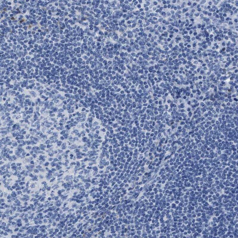 alcohol dehydrogenase 4 Antibody - BSA Free Immunohistochemistry: alcohol dehydrogenase 4 Antibody - BSA Free [NBP1-90233]