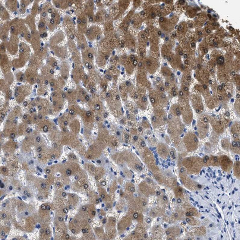 alcohol dehydrogenase 4 Antibody - BSA Free Immunohistochemistry: alcohol dehydrogenase 4 Antibody - BSA Free [NBP1-90233]