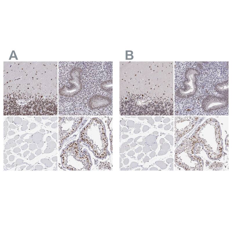 ADAR Antibody Immunohistochemistry-Paraffin: ADAR Antibody Antibody [NBP1-90242]