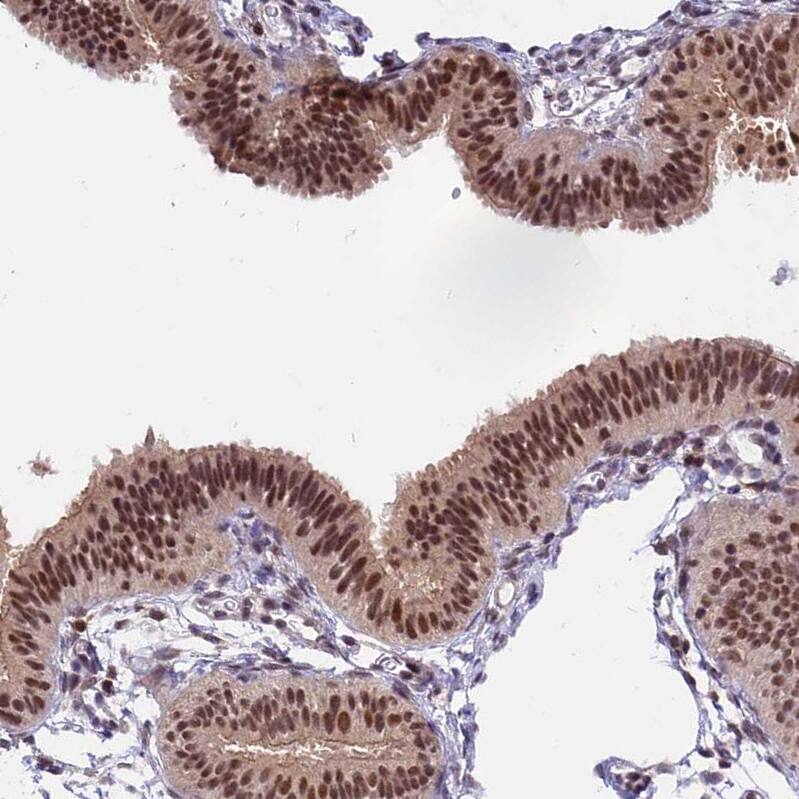 TADA3L Antibody - BSA Free Immunohistochemistry: TADA3L Antibody - BSA Free [NBP1-90243]