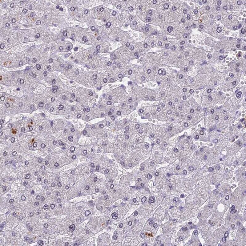 TADA3L Antibody - BSA Free Immunohistochemistry: TADA3L Antibody - BSA Free [NBP1-90243]