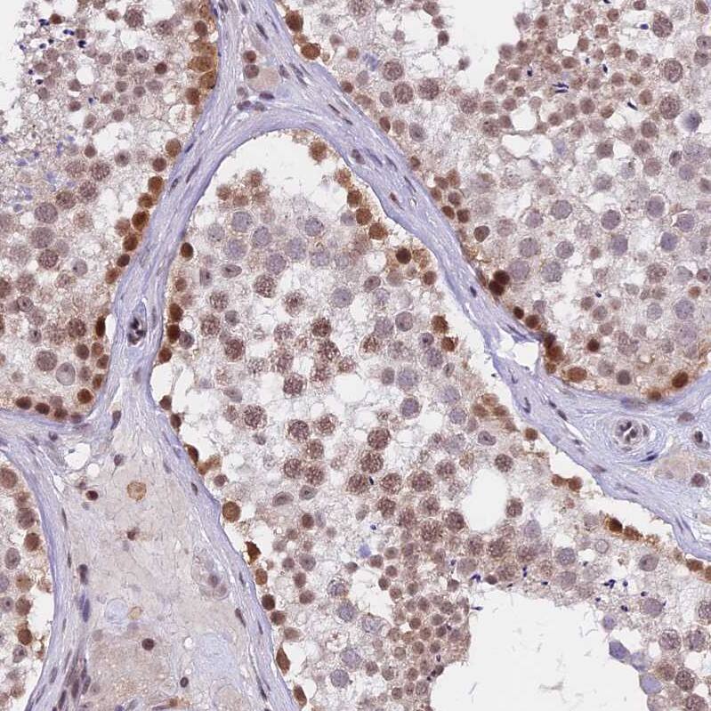 TADA3L Antibody - BSA Free Immunohistochemistry: TADA3L Antibody - BSA Free [NBP1-90243]