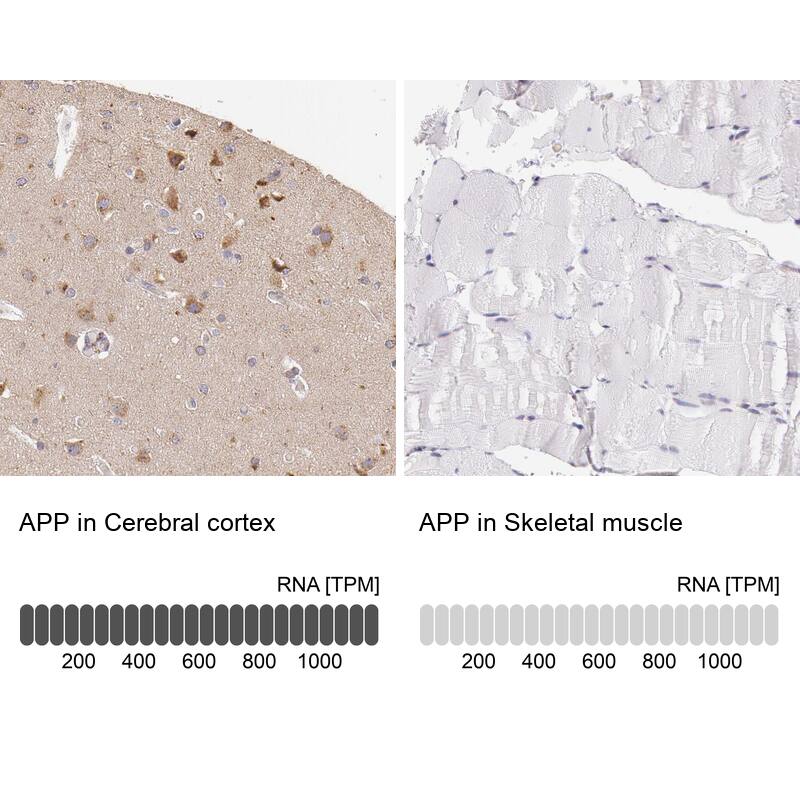 APP Antibody - BSA Free Immunohistochemistry: APP Antibody - BSA Free [NBP1-90246]