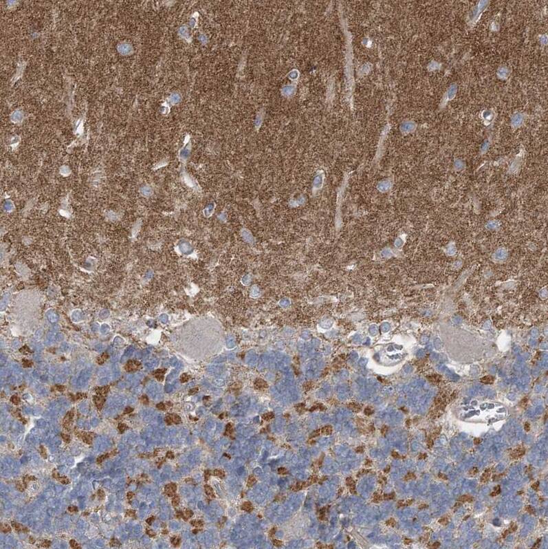 Piccolo Antibody - BSA Free Immunohistochemistry: Piccolo Antibody - BSA Free [NBP1-90250]