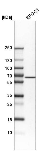 ALK-1 Antibody - BSA Free Western Blot: ALK-1 Antibody - BSA Free [NBP1-90254]