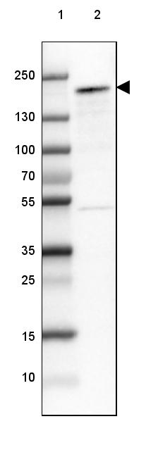 NCOA3/AIB1 Antibody - BSA Free Western Blot: NCOA3/AIB1 Antibody - BSA Free [NBP1-90256]