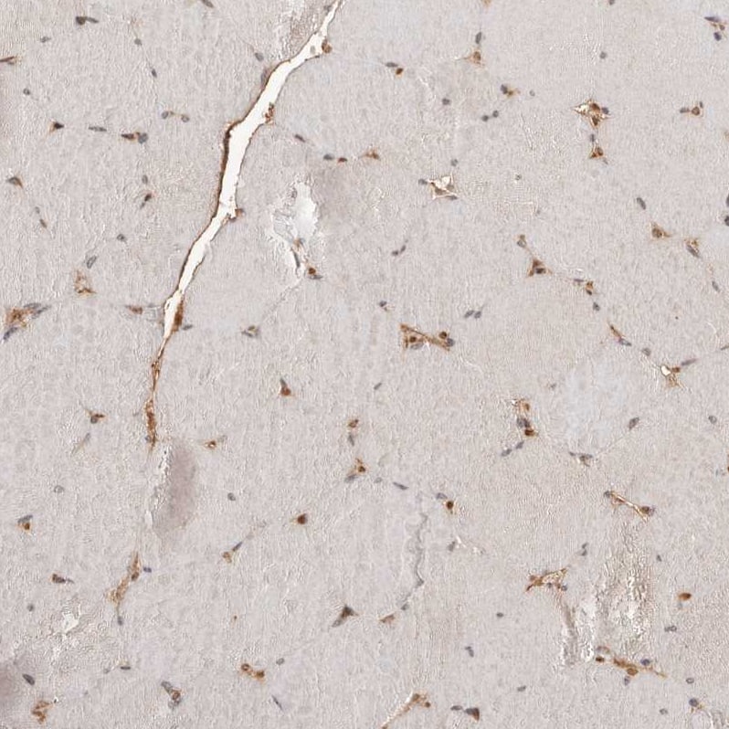 NCOA3/AIB1 Antibody - BSA Free Immunohistochemistry: NCOA3/AIB1 Antibody - BSA Free [NBP1-90256]