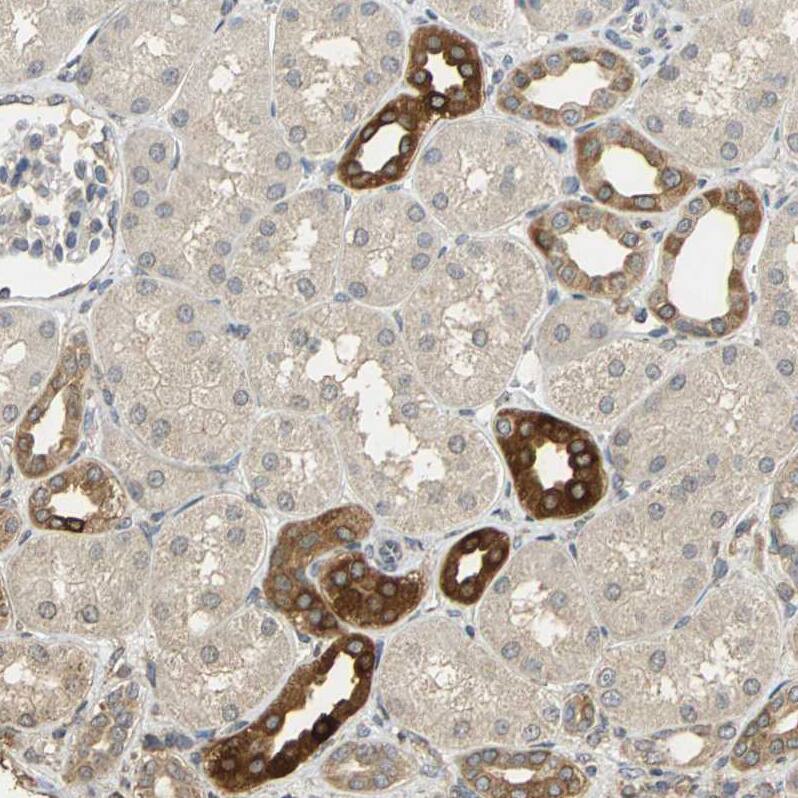 FACL4 Antibody - BSA Free Immunohistochemistry: FACL4 Antibody - BSA Free [NBP1-90258]