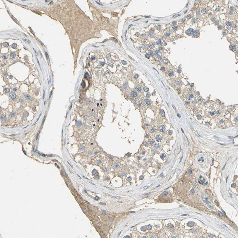 FACL4 Antibody - BSA Free Immunohistochemistry: FACL4 Antibody - BSA Free [NBP1-90258]